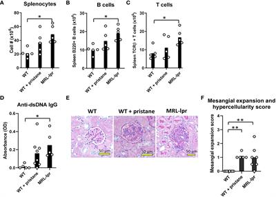 Distinct RBC alloantibody responses in type 1 interferon-dependent and -independent lupus mouse models